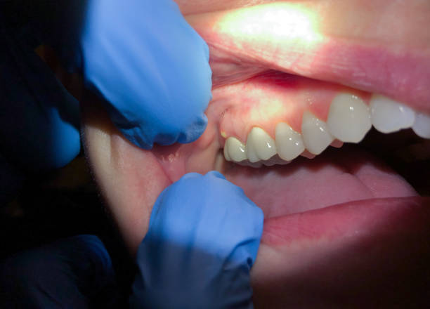 Best Cracked Tooth Emergency Dentist  in Quail Creek, TX